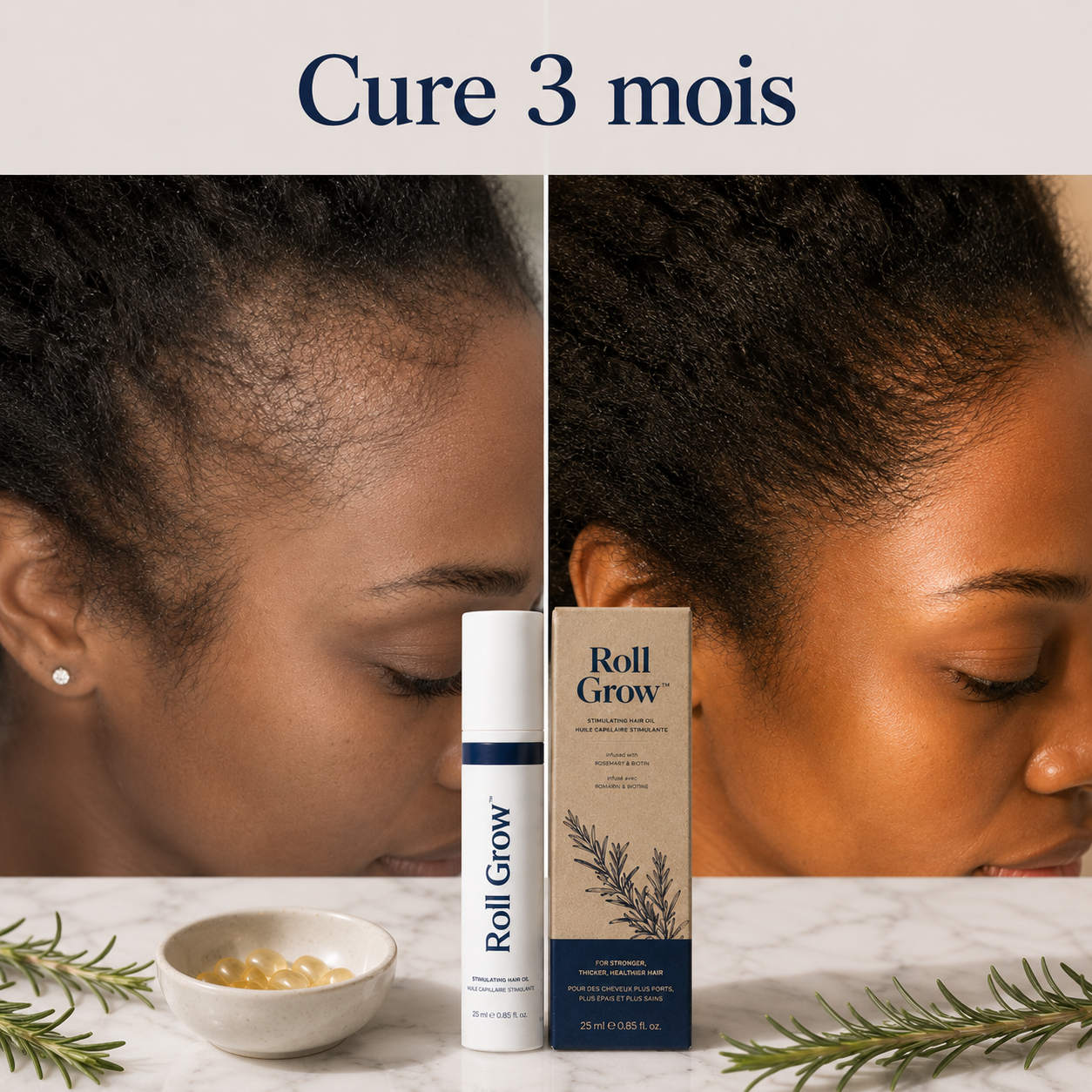 Roll Grow™ — Sérum Repousse Ciblée · Romarin & Biotine