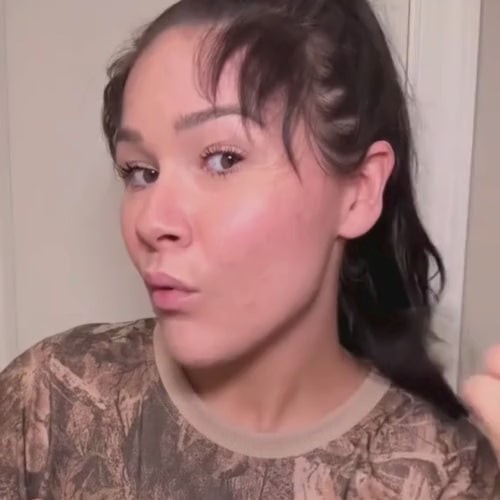 Roll Grow™ – Sérum Anti-Alopécie & Repousse Tempes Dégarnies