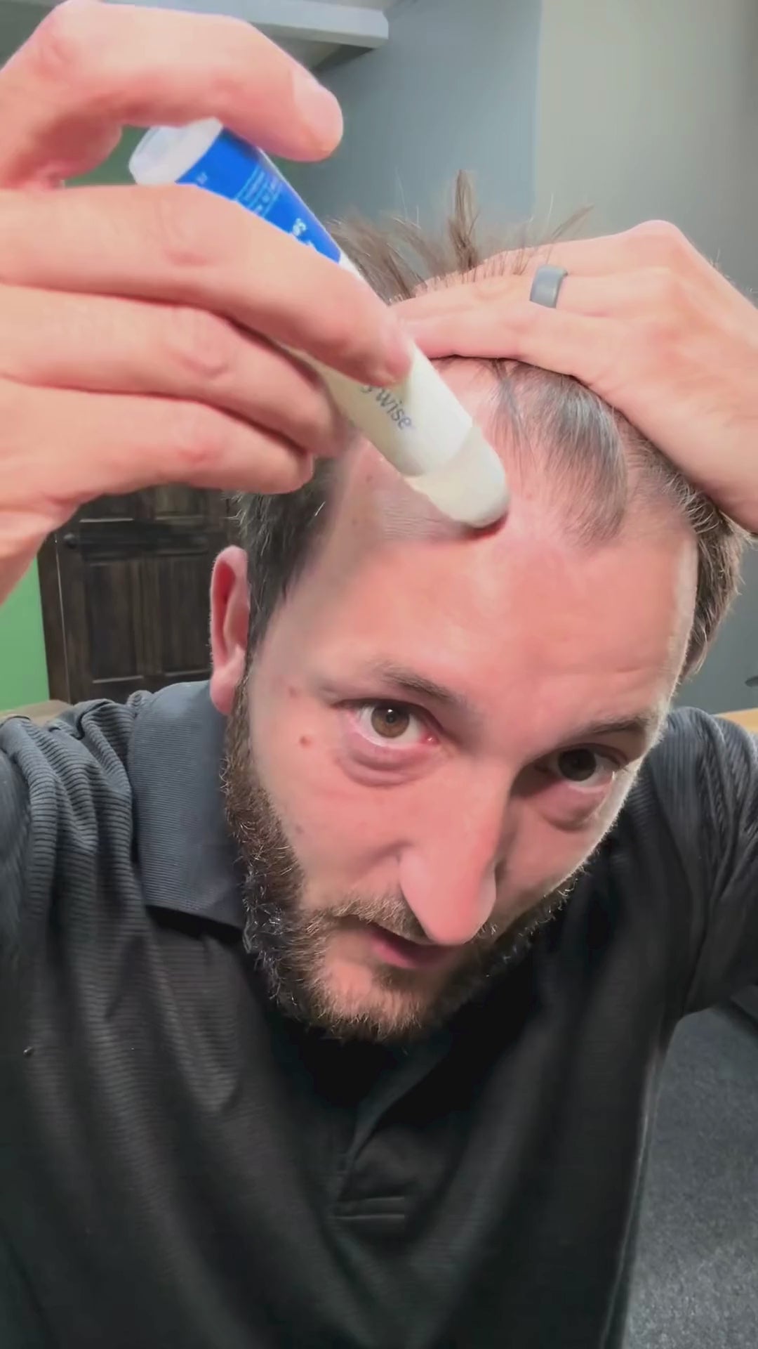 Roll Grow™ – Sérum Anti-Alopécie & Repousse Tempes Dégarnies